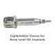 Explantation device for BL NC implants(153030)