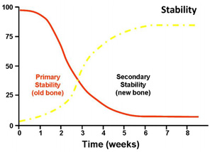 BIOCONCEPT S-L-A Implant Stability-Time Table