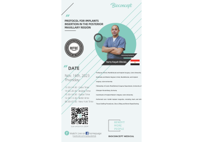 Protocal for Implants Insertiion in the Posterior Maxillary Region - by Dr.Ramy Ragab Elbeialy