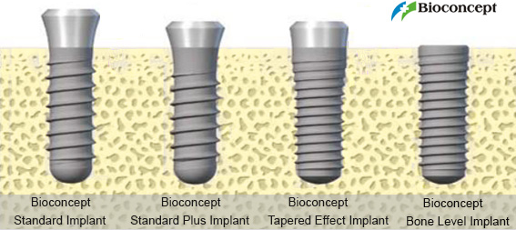 BIOCONCEPT Dental Implant System